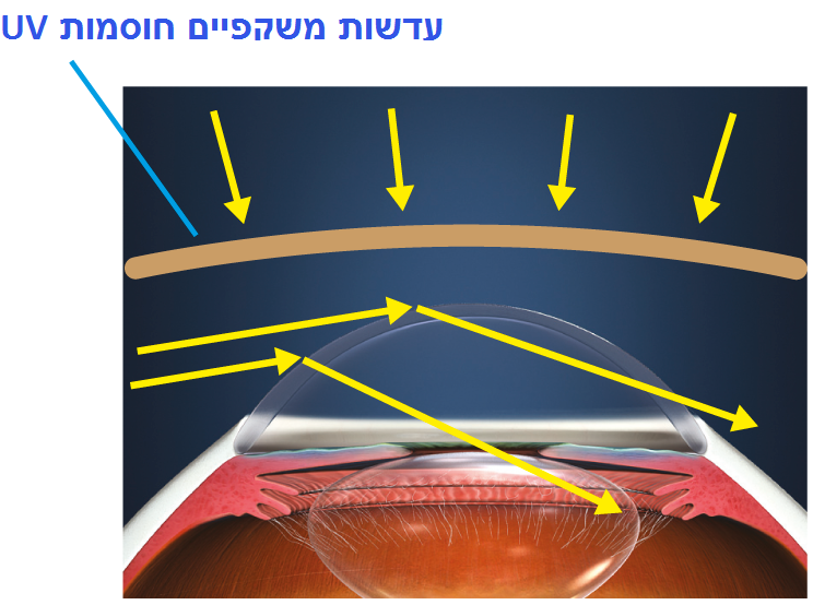 UV-blocking spectacle lens